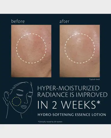 CLÉ DE PEAU BEAUTÉ Hydro-Softening Essence Lotion, 5.7 oz. | Thumbnail 2 CLÉ DE PEAU BEAUTÉ Hydro-Softening Essence Lotion, 5.7 oz. | Thumbnail 2