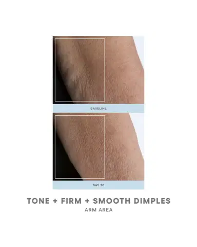 NUFACE NuBODY Skin Toning Kit | Thumbnail 5 NUFACE NuBODY Skin Toning Kit | Thumbnail 5