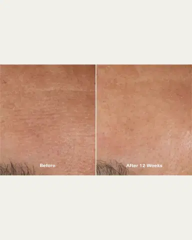 La Mer The Moisturizing Soft Cream, 2.0 oz. | Thumbnail 5 La Mer The Moisturizing Soft Cream, 2.0 oz. | Thumbnail 5