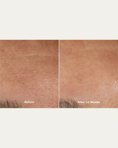 La Mer The Moisturizing Soft Cream, 0.5 oz. | Thumbnail 5 La Mer The Moisturizing Soft Cream, 0.5 oz. | Thumbnail 5