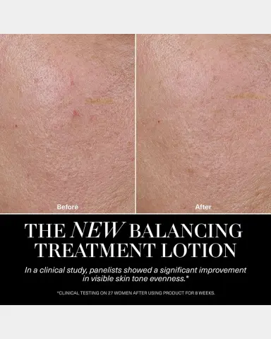La Mer The Balancing Treatment Lotion, 5 oz. | Thumbnail 5 La Mer The Balancing Treatment Lotion, 5 oz. | Thumbnail 5