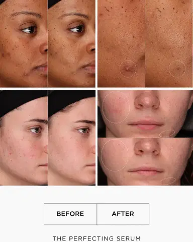 LALAIS The Perfecting Serum, 0.5 oz. | Thumbnail 4 LALAIS The Perfecting Serum, 0.5 oz. | Thumbnail 4
