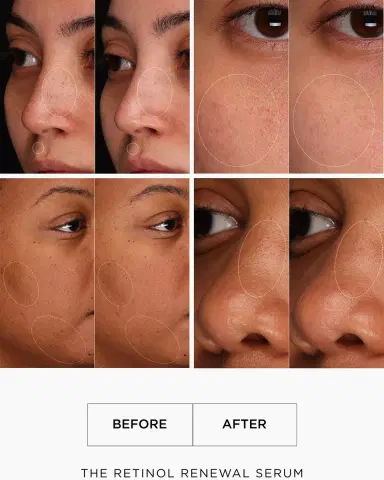 LALAIS The Retinol Renewal, 1 oz. | Thumbnail 5 LALAIS The Retinol Renewal, 1 oz. | Thumbnail 5