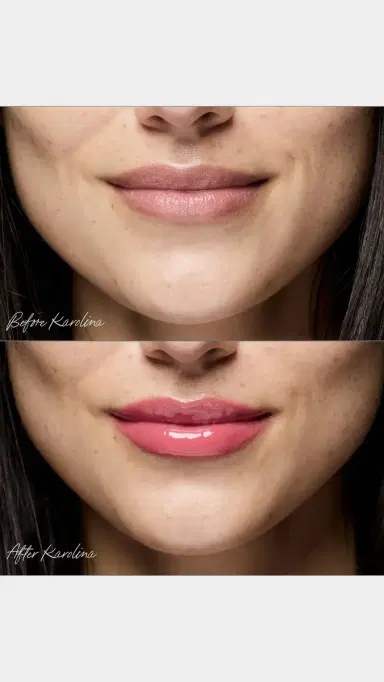 RMS Beauty Legendary Lip Oil | Thumbnail 4 RMS Beauty Legendary Lip Oil | Thumbnail 4
