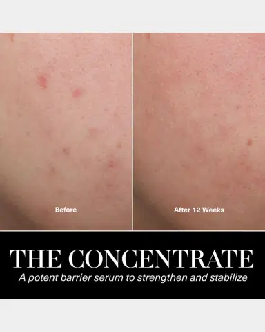 La Mer The Concentrate - Soothing & Strengthening Face Serum | Thumbnail 8 La Mer The Concentrate - Soothing & Strengthening Face Serum | Thumbnail 8