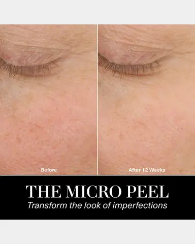 La Mer The Micro Peel Treatment, 1 oz. | Thumbnail 8 La Mer The Micro Peel Treatment, 1 oz. | Thumbnail 8