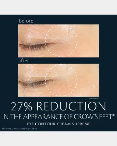 CLÉ DE PEAU BEAUTÉ Eye Contour Cream Supreme, 0.5 oz. | Thumbnail 6 CLÉ DE PEAU BEAUTÉ Eye Contour Cream Supreme, 0.5 oz. | Thumbnail 6