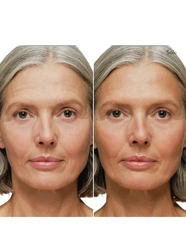 CHANTECAILLE Real Bronze Gel-Powder Bronzer | Thumbnail 1 CHANTECAILLE Real Bronze Gel-Powder Bronzer | Thumbnail 1
