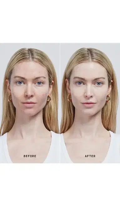 VERSED Skin Solution Multi-Serum Skin Tint SPF 40 | Thumbnail 3 VERSED Skin Solution Multi-Serum Skin Tint SPF 40 | Thumbnail 3