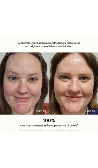 VERSED Skin Refine Gentle Pore Clearing Serum | Thumbnail 3 VERSED Skin Refine Gentle Pore Clearing Serum | Thumbnail 3