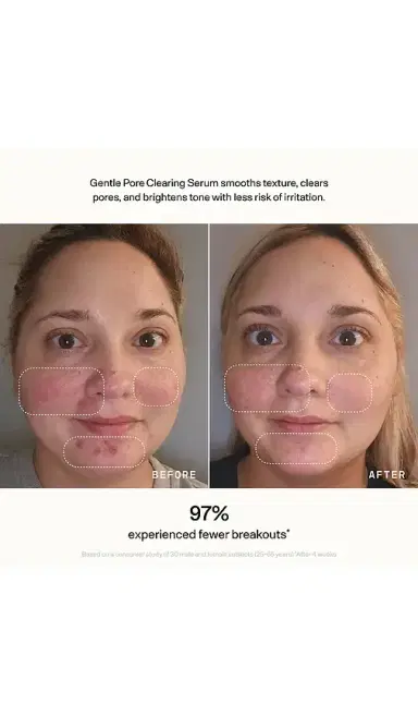 VERSED Skin Refine Gentle Pore Clearing Serum | Thumbnail 4 VERSED Skin Refine Gentle Pore Clearing Serum | Thumbnail 4