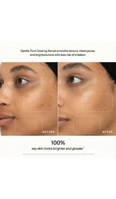 VERSED Skin Refine Gentle Pore Clearing Serum | Thumbnail 5 VERSED Skin Refine Gentle Pore Clearing Serum | Thumbnail 5