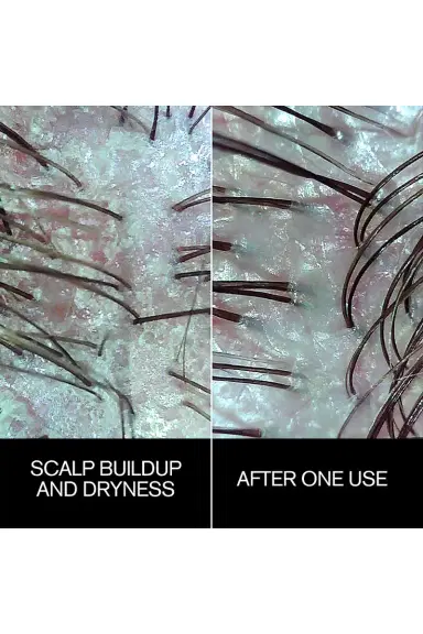 Najeau Follicle Drops | Thumbnail 4 Najeau Follicle Drops | Thumbnail 4