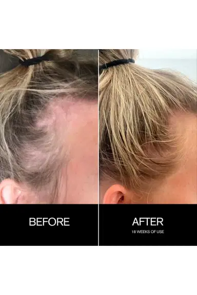 Najeau Follicle Drops | Thumbnail 7 Najeau Follicle Drops | Thumbnail 7