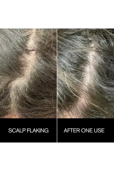 Najeau Sunday Scalp Mask | Thumbnail 5 Najeau Sunday Scalp Mask | Thumbnail 5