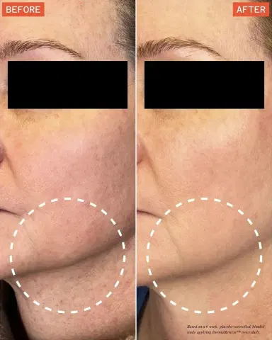 Dr. Few DermaReverse GLP Serum, 1 oz. | Thumbnail 4 Dr. Few DermaReverse GLP Serum, 1 oz. | Thumbnail 4