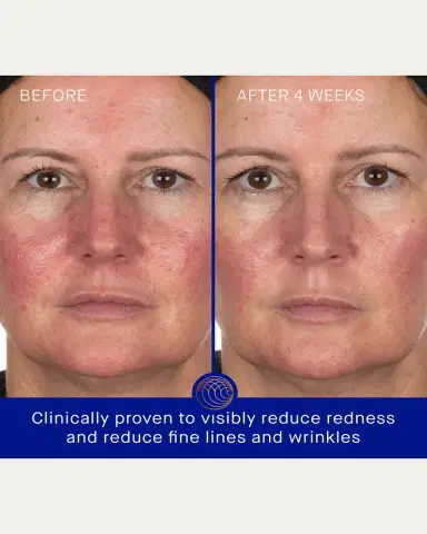 Augustinus Bader The Hydrogel Face Mask, 6 pack | Thumbnail 4 Augustinus Bader The Hydrogel Face Mask, 6 pack | Thumbnail 4