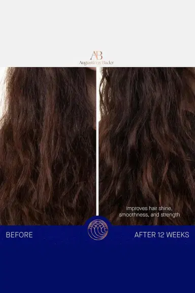 Augustinus Bader The Leave-In Hair Treatment | Thumbnail 2 Augustinus Bader The Leave-In Hair Treatment | Thumbnail 2