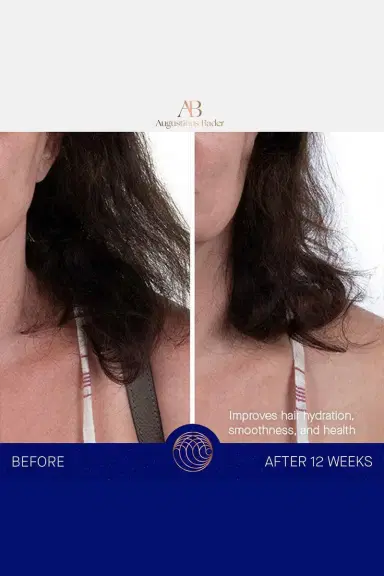 Augustinus Bader The Leave-In Hair Treatment | Thumbnail 6 Augustinus Bader The Leave-In Hair Treatment | Thumbnail 6