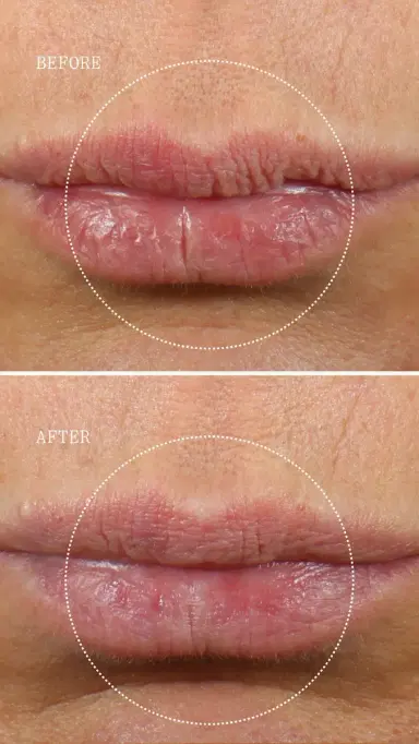 Dr. Marnie Lip Serum | Thumbnail 4 Dr. Marnie Lip Serum | Thumbnail 4