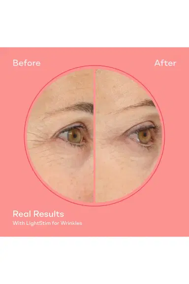 LightStim LightStim for Wrinkles | Thumbnail 9 LightStim LightStim for Wrinkles | Thumbnail 9