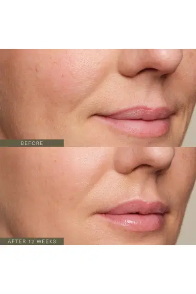 Oak Essentials Firming Plant Peptide Serum | Thumbnail 4 Oak Essentials Firming Plant Peptide Serum | Thumbnail 4