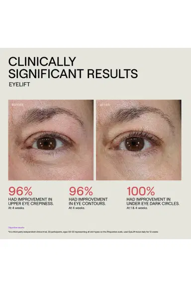 Dr. Diamond's Metacine EyeLift Bioremodeling Peptide Multiplex | Thumbnail 6 Dr. Diamond's Metacine EyeLift Bioremodeling Peptide Multiplex | Thumbnail 6