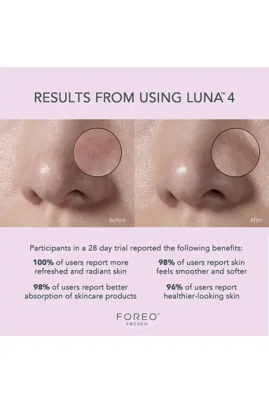 Foreo Luna 4 Facial Cleansing & Firming Device For Sensitive Skin | Thumbnail 4 Foreo Luna 4 Facial Cleansing & Firming Device For Sensitive Skin | Thumbnail 4