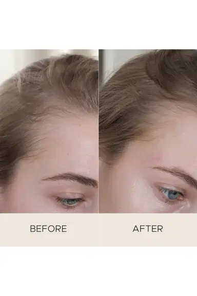 Christophe Robin Fortifying Scalp Serum With Amaranth Peptides | Thumbnail 3 Christophe Robin Fortifying Scalp Serum With Amaranth Peptides | Thumbnail 3