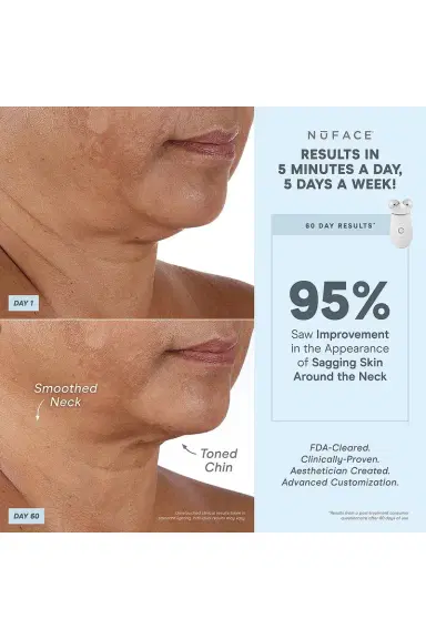 NUFACE Trinity+ LED Red Light Wrinkle Reducer Attachment | Thumbnail 6 NUFACE Trinity+ LED Red Light Wrinkle Reducer Attachment | Thumbnail 6