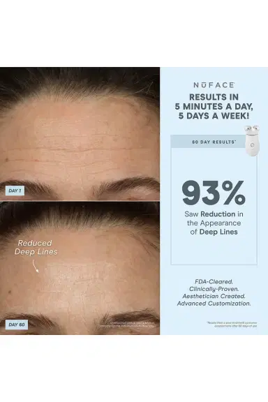 NUFACE Trinity+ LED Red Light Wrinkle Reducer Attachment | Thumbnail 8 NUFACE Trinity+ LED Red Light Wrinkle Reducer Attachment | Thumbnail 8