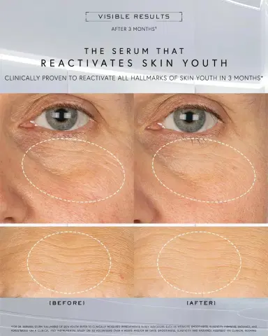Dr. Barbara Sturm Super Anti-Aging Serum, 1 oz. | Thumbnail 2 Dr. Barbara Sturm Super Anti-Aging Serum, 1 oz. | Thumbnail 2